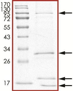 Sino Biological&nbsp;Recombinant Human VHL/ELOB/ELOC/CUL2/RBX1 complex Protein (Full Length, His Tag)